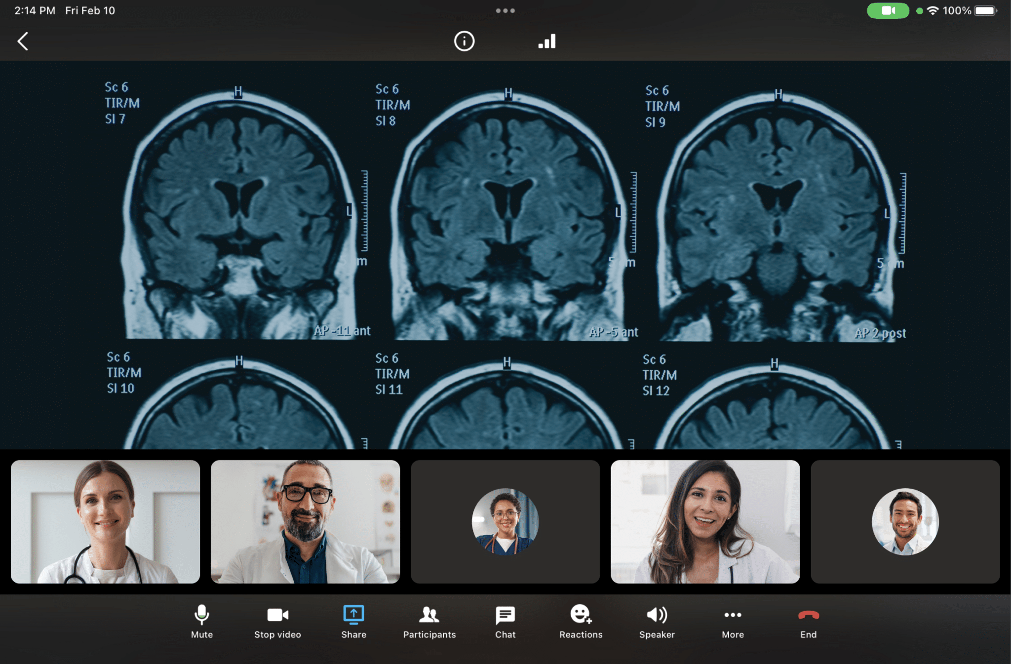 Physicians looking at a scan virtually via RingCentral Video